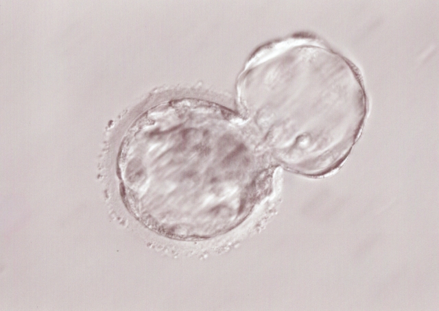 高度な体外受精の画像